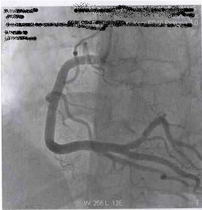 dsaҽѧ����ʲô��˼ ����dsa��Ӱ��ʲô���