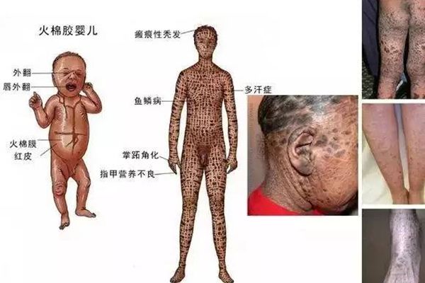 ���޽�Ӥ�������ͼƬ ������ָ�������