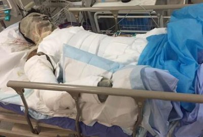 偷钓鱼触碰高压线结果是什么 一男子钓鱼触碰高压电当场被电晕