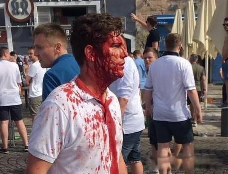 俄罗斯为什么叫战斗民族 做事能动手就不动嘴