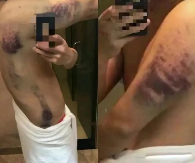 ��鱱����ʵ����ж�ֲ� ����µĵط�ʧ�ػ���