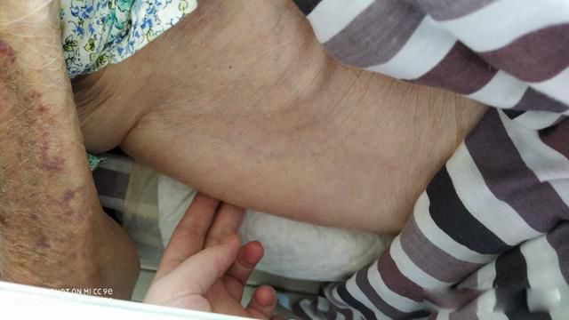 ��������ǰ����������Щ ������Щ�쳣�����׵�