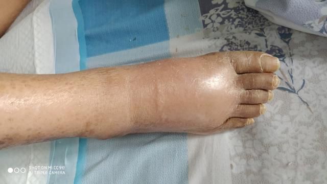 ��������ǰ����������Щ ������Щ�쳣�����׵�