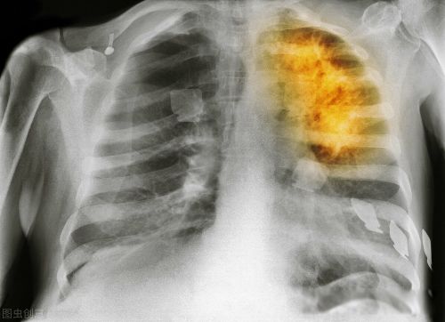 ��֢��ʲôԭ����ɵ� �����°�������Ҫ��