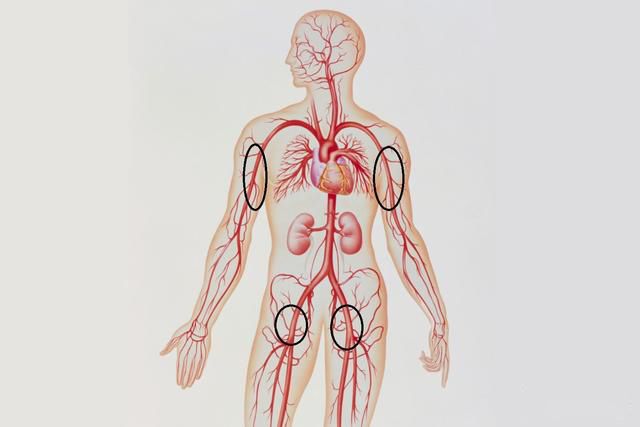 人彘是什么意思啊 不能长时间存活的两个必死难关