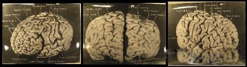 爱因斯坦的大脑为什么拿去做实验 为人类解开天才大脑之谜