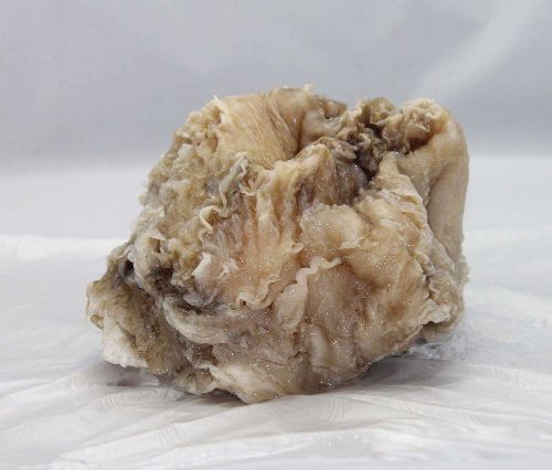 太岁是什么东西 一种粘菌的复合体