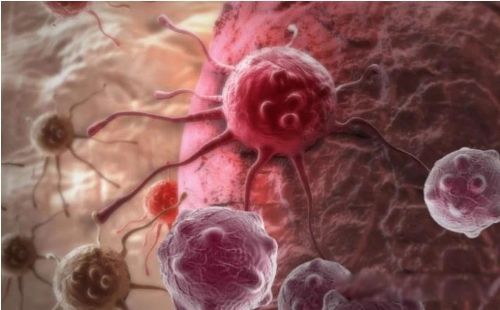 癌症是什么原因造成的 根本原因是基因突变导致的