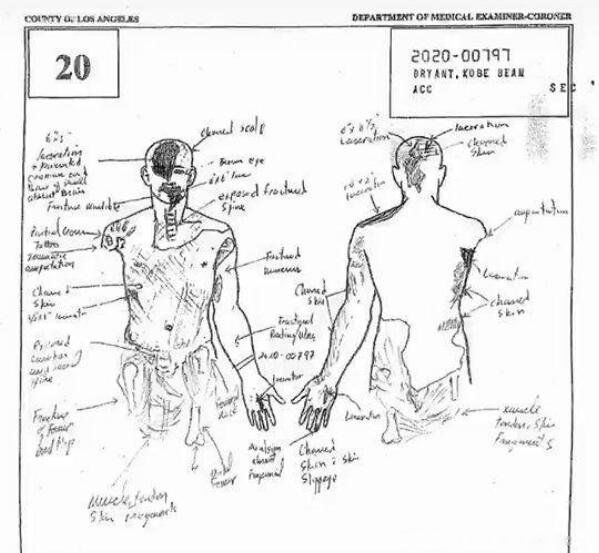 �Ʊȱ��ճ�һ��5ͼƬ �Ź���Ƭԭͼ153�¼�