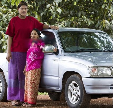 现年只有17岁的泰国女孩玛丽·杜安格迪已达到2.