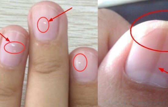 ָ����������ô���� �������԰�͹��ƽԤʾʲô����