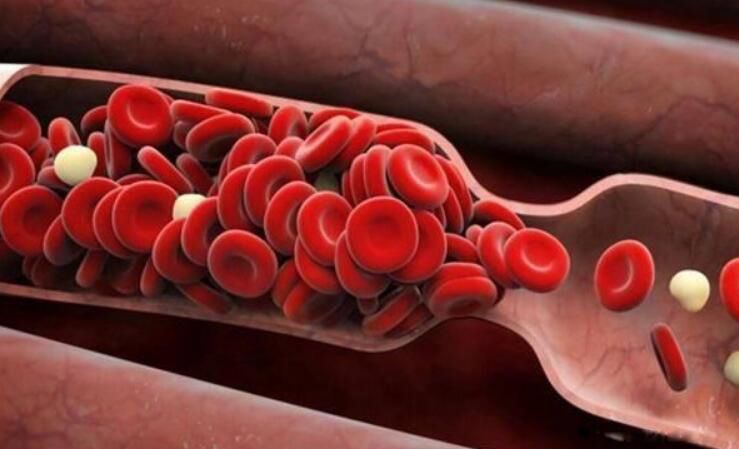 o��Ѫ������Ѫ�� �жັ��o��Ѫ����èѪ����