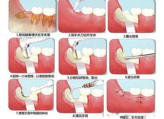 ���ǳݻ����������� �ε��ǳݺ������