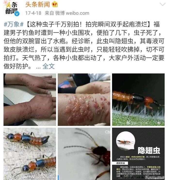 �����ҧ�˺�ͼƬ ҧ������Ч�Ĵ�������