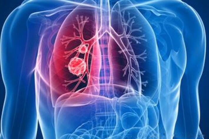 ��������λ�÷ֲ�ʾ��ͼ �������λ���ٶ���ͼ