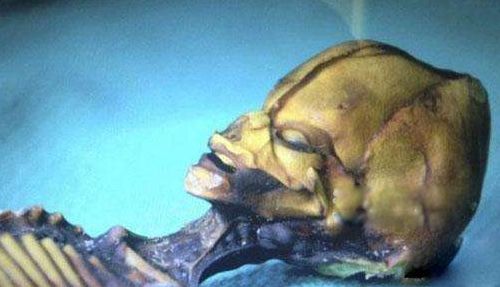 �����˴����� ���ص���������ʲô��˼