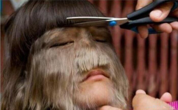 ��������ɺ��ë֢��ô���� ������ë���������Ϊʲô