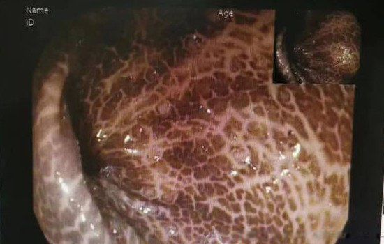 ���ڳԽ��ض�������û��Σ�� ���ӱ����������