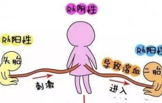 熊猫血是什么血型 o型血是熊猫血吗