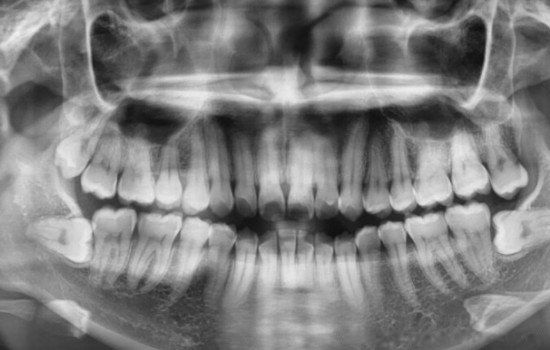 ���ǳݻ������ ���ǳݰε���������