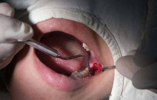 ���ǳݻ������ ���ǳݰε���������