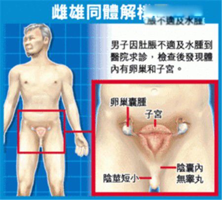 雌雄同体人什么意思 是男是女什么样的