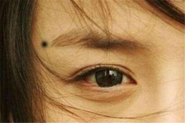 女人少见的极富贵痣有哪些 女人10处有痣是富贵痣盘点