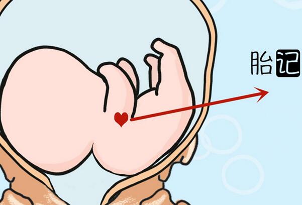 ��ɫ̥�����˵����ʲô ��ɫ̥�ǵĴ�˵��ǰ���й�