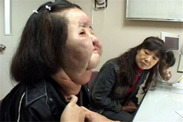 世界上最丑的人是哪个人 你知道世界上最丑的人是谁吗
