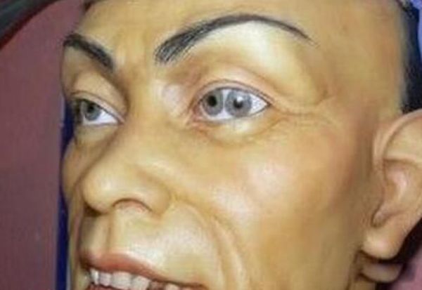 双瞳孔,又叫重瞳,双瞳和多瞳,指的是一个眼睛里面有两个瞳孔,双瞳孔的