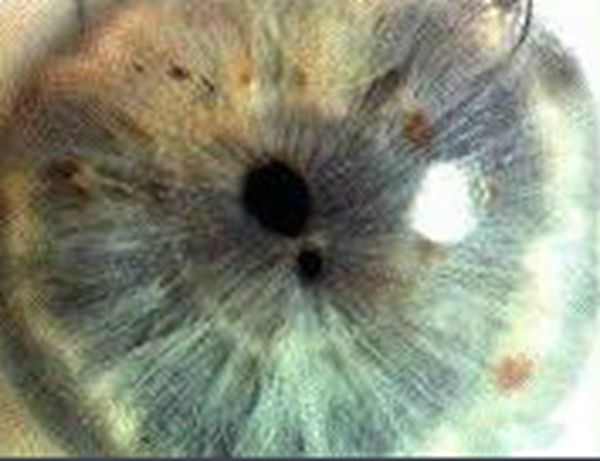 ˫ͫ�׵��˳�ʲô�� ��ʵ��˫ͫ����Ĵ�����