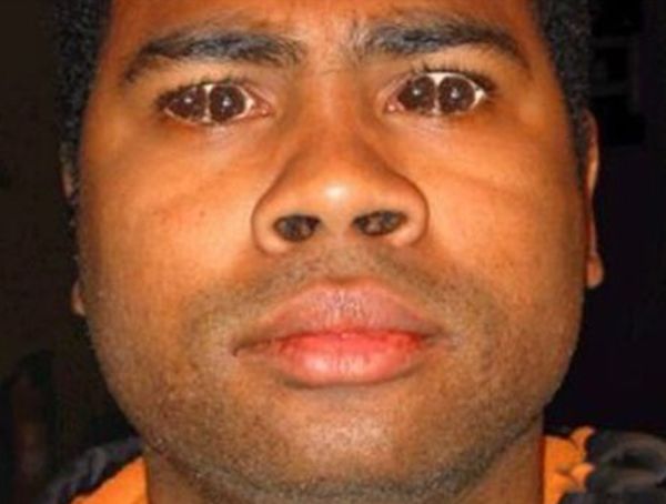 ˫ͫ�׵��˳�ʲô�� ��ʵ��˫ͫ����Ĵ�����