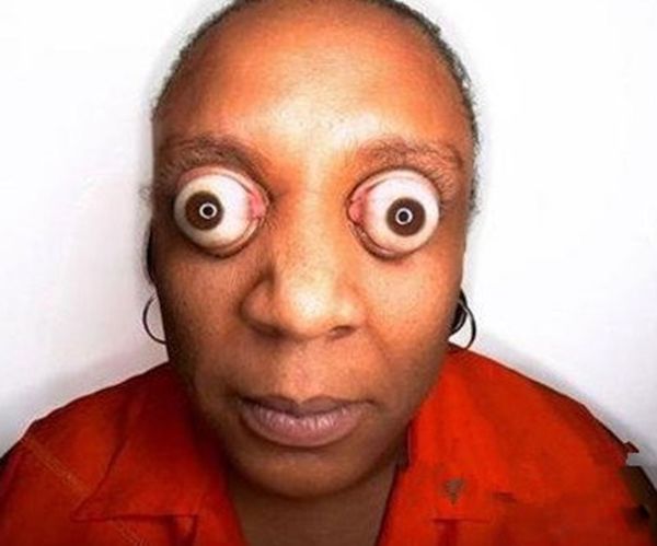 ˫ͫ�׵��˳�ʲô�� ��ʵ��˫ͫ����Ĵ�����