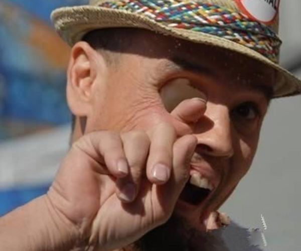 ˫ͫ�׵��˳�ʲô�� ��ʵ��˫ͫ����Ĵ�����