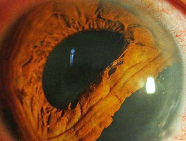 ˫ͫ�׵��˳�ʲô�� ��ʵ��˫ͫ����Ĵ�����