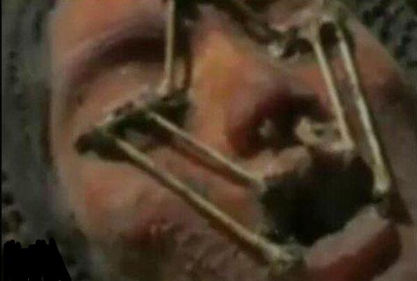 ����Ůʬ��� ��������Ůʬ�������