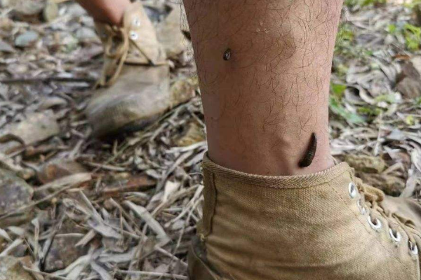 山蚂蝗的图片长什么样子 什么可以灭山蚂蝗