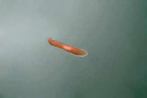 恶心虫子图片 超恶心的10大寄生虫是什么