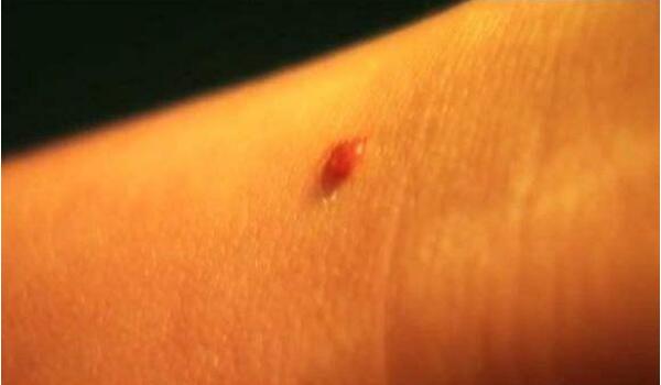 �ع�ɰ���ĸ�λ��ͼƬ���ֱ�ʲôλ�� ��Ϊʲô����ͬ������ʧ