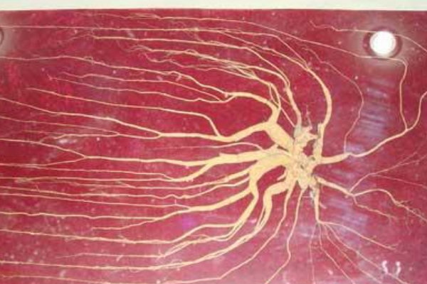 Ŀǰ�����˲�������Ƕ��� ���������ϵ��˲��Ƕ�����