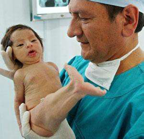 �������ۺ�֢��ʲô��֢ ��ʲô����ͼƬ