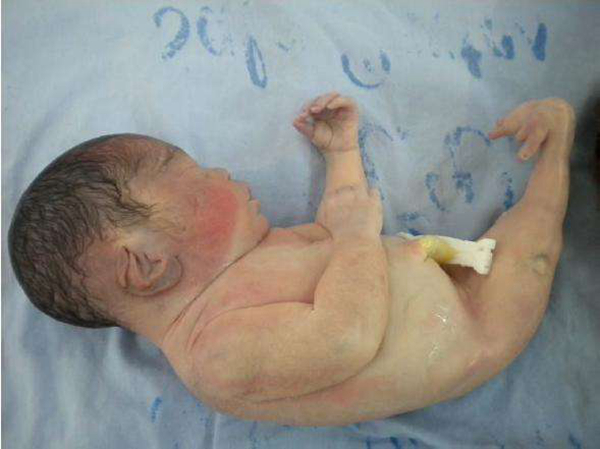 �������ۺ�֢��ʲô��֢ ��ʲô����ͼƬ