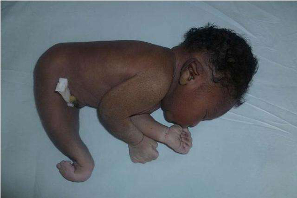 �������ۺ�֢��ʲô��֢ ��ʲô����ͼƬ