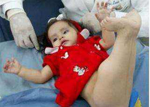 �������ۺ�֢��ʲô��֢ ��ʲô����ͼƬ