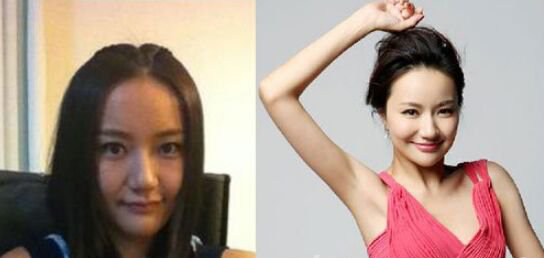 韩雨芹整容了吗 否认变靓不是因为整容