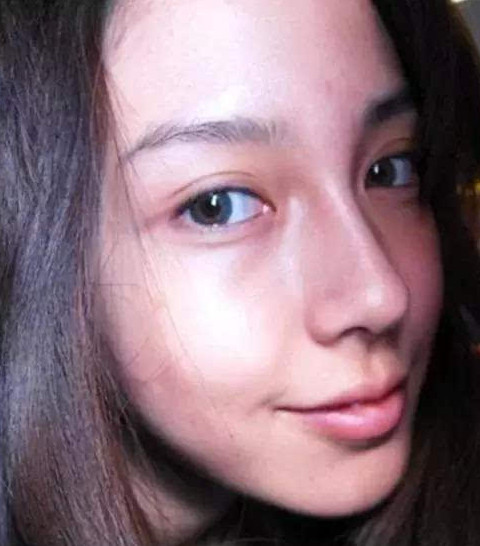 angelababy整容前后照片对比 大方承认整过牙齿