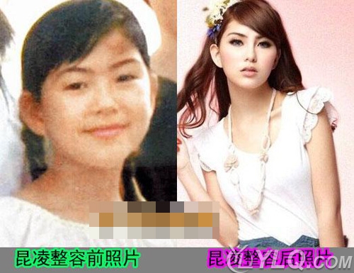 昆凌真实长相照片 昆凌家庭背景简介