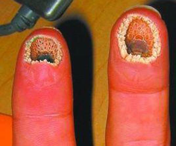 ���������ָ��ʲô�� ��Щ����ͼƬ