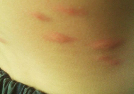 �����ϱ�����ҧ��ͼƬ��ȫ Ԥ���������֪ʶ