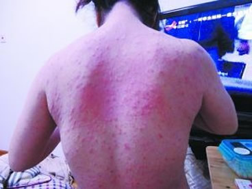 �����ϱ�����ҧ��ͼƬ��ȫ Ԥ���������֪ʶ